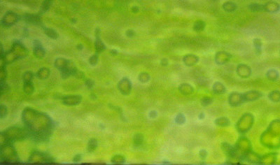 ブルズアイ リングモトル