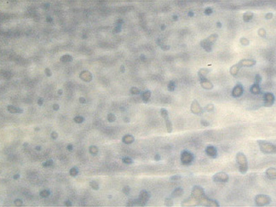 ブルズアイ リングモトル